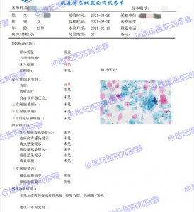 ​良性反应性改变是什么意思（妇科良性反应性改变是什么意思）